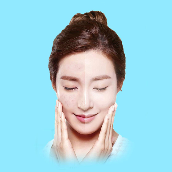 1 Electric Rechargeable Blackhead Remover